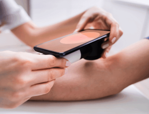 Can Urgent Care Diagnose Skin Cancer? 