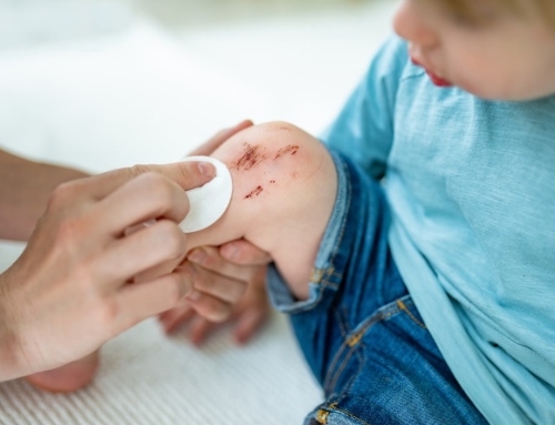 How to Treat Cuts, Scrapes & Bug Bites This Summer (And When to See a Doctor)